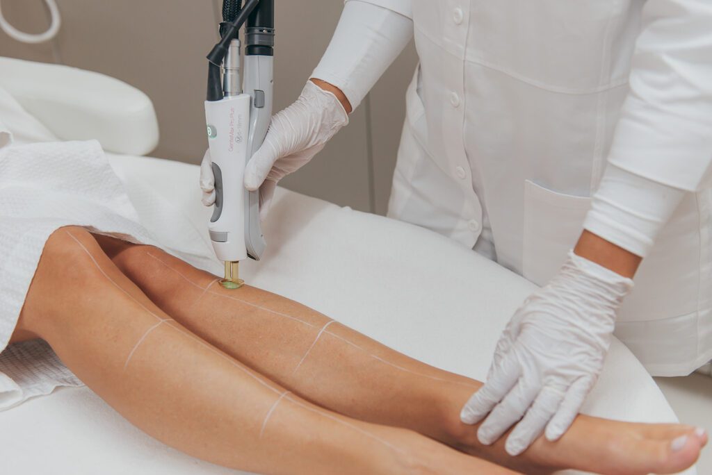 Laser clinic Schiedam interieur
